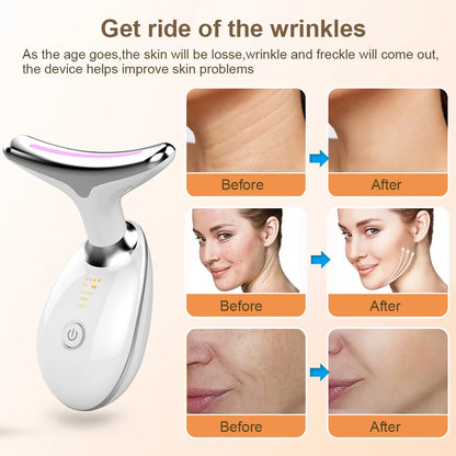 SkinLift™ Massager